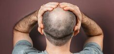 Calvitie : que perdent les hommes lorsqu’ils perdent leurs cheveux ?