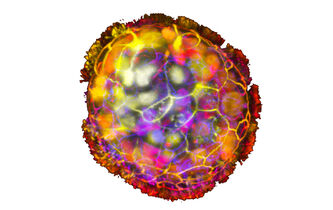 Anthrobot : l’ère des machines vivantes ? 