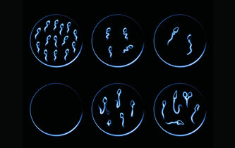 Gamètes over ? La chronique d’Anne-Sophie Moreau