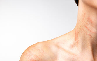 Le défi TikTok de la cicatrice et le sens des marques